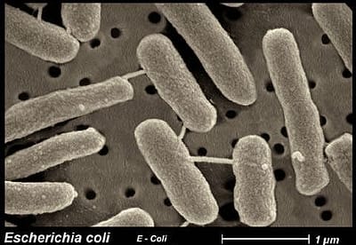 Baktérie z čelade Enterobacteriaceae