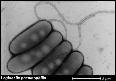 Patogénne baktérie z čelade Legionellaceae