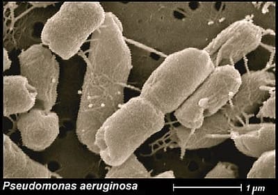 Patogénne baktérie z rodu Pseudomonas