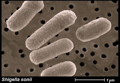 Patogénne baktérie z čelade Enterobacteriaceae